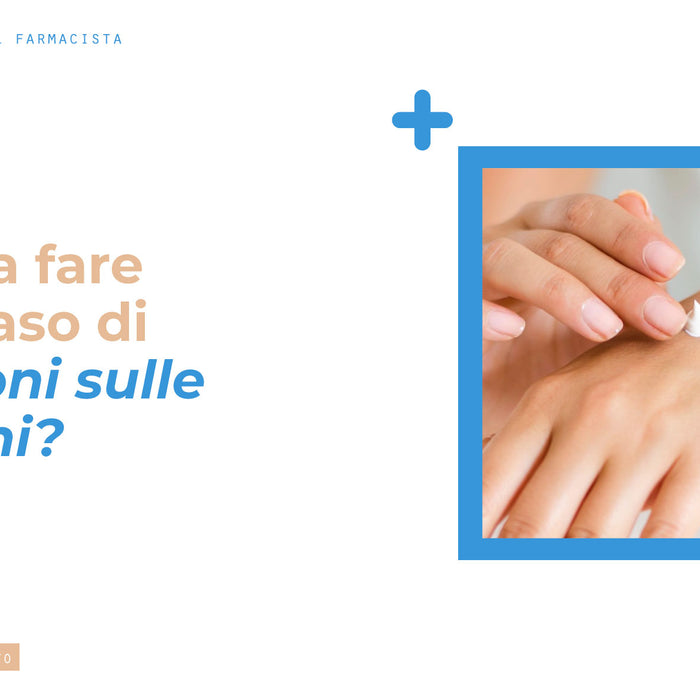 Geloni alle mani: cosa sono e come si curano